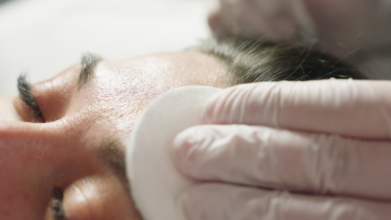 Close up of spa guest forehead being gently rubbed with soft cotton pad by gloved beauty technician during facial treatment in bright clinical setting with ambient lighting and serene atmosphere