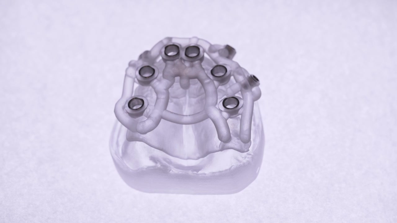 Close up of a hand adjusting a clear denture mold with metal implants on a white background