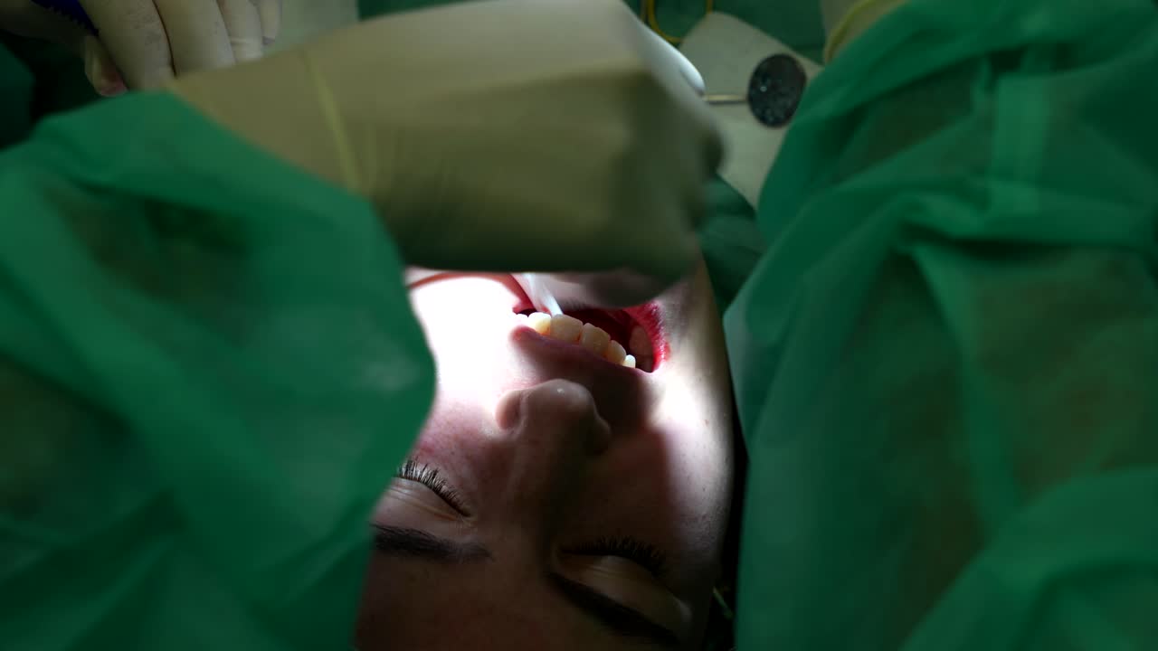 Dentisti che suturano, tagliano il filo e continuano a lavorare sulla bocca del paziente. Angolazione dall'alto, primo piano.