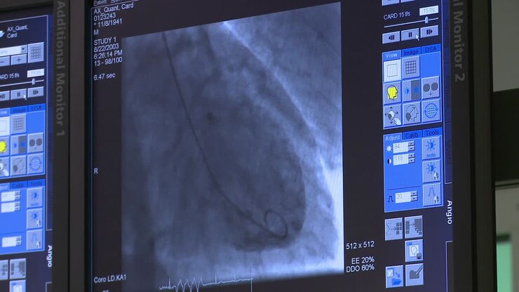 Scansione cardiaca di camere, valvole, vasi sanguigni e prestazioni del cuore