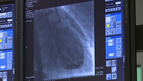 cardiac scan of chambers, valves, blood vessels and heart performance