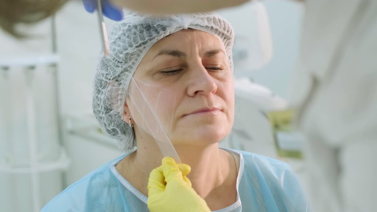 marcado antes de los procedimientos para el rejuvenecimiento de la piel de la cara. cosmetología de hardware profesional