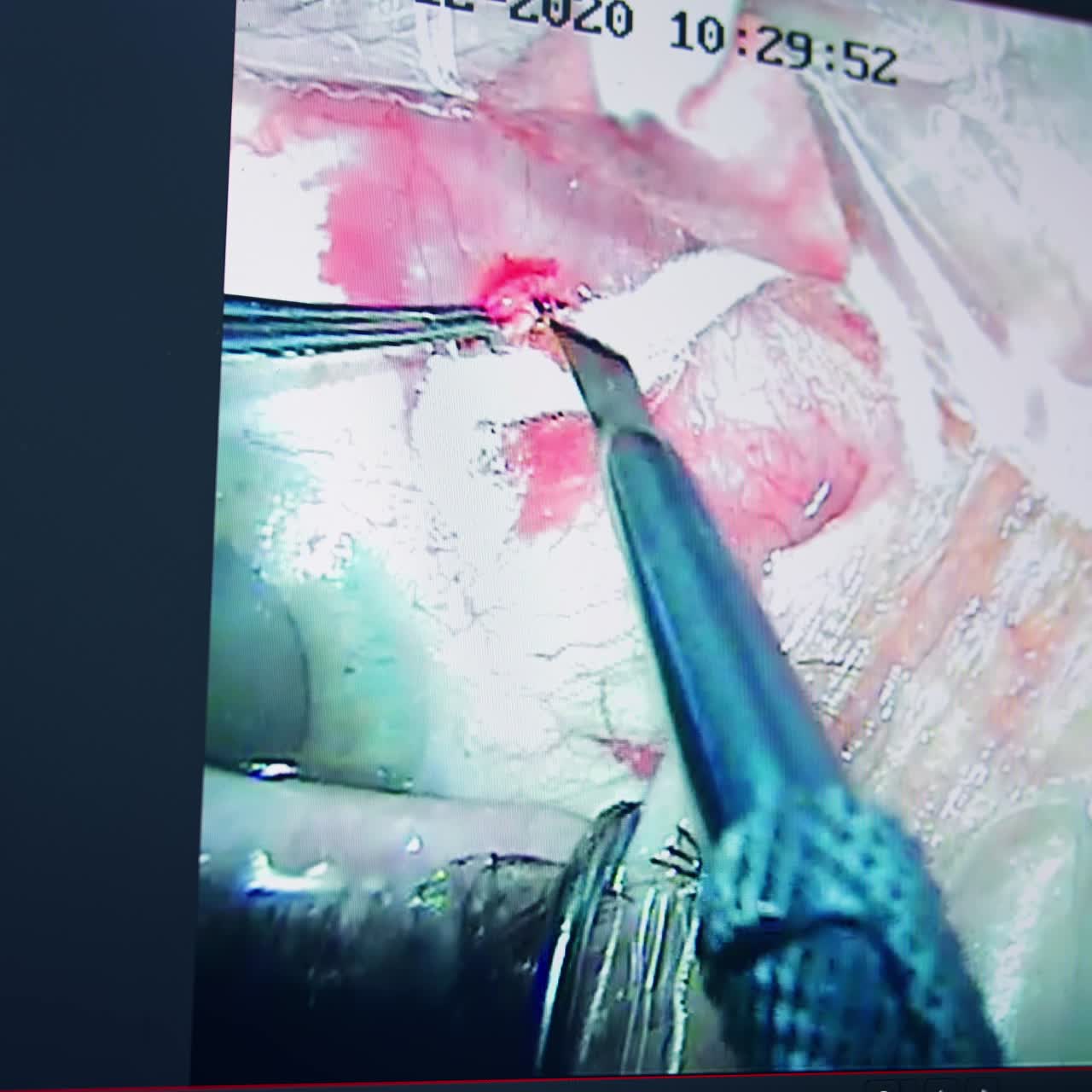 Close up of operation of sight