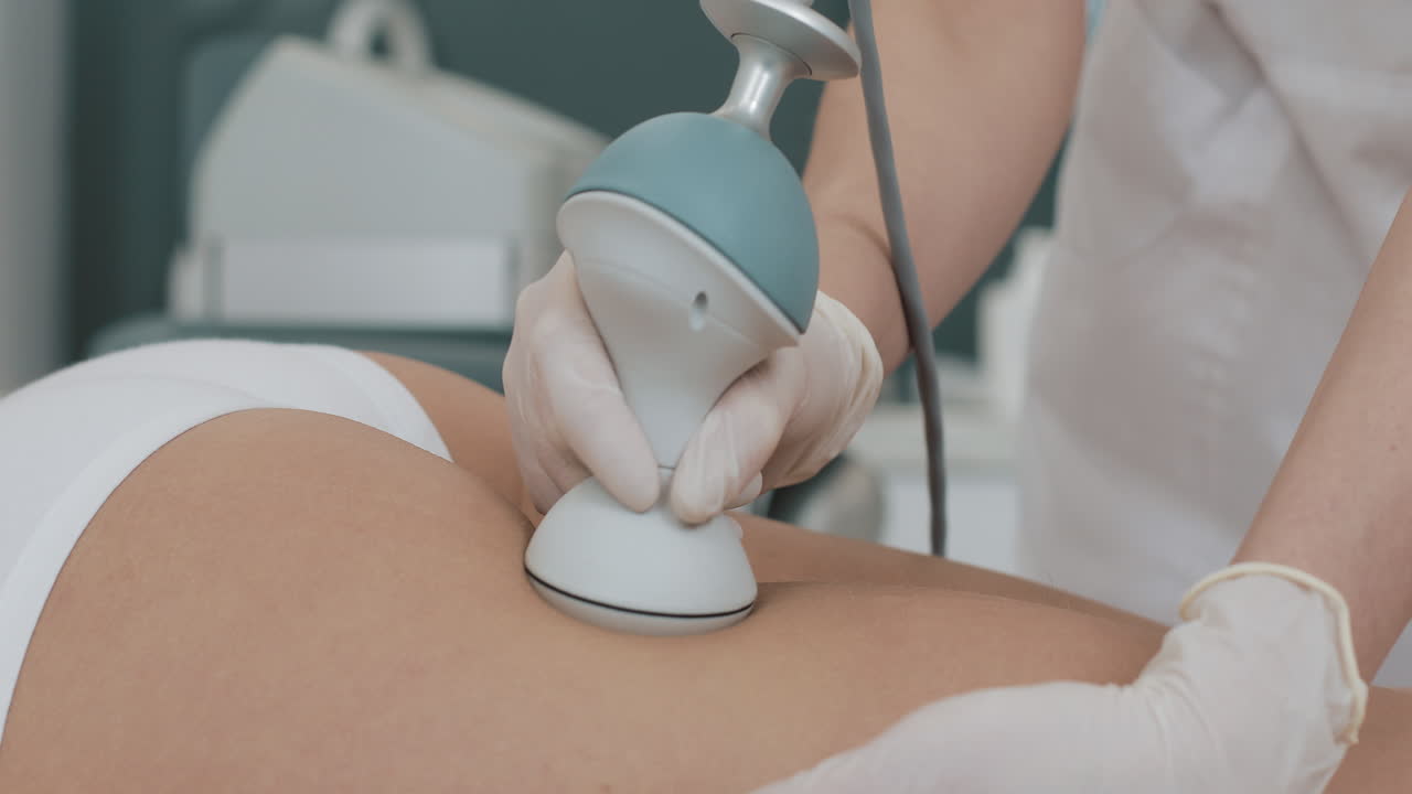 Cellulite Treatment Procedure