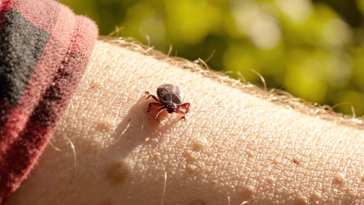 Primer plano de una garrapata arrastrándose sobre la piel, destacando la importancia de la concienciación al aire libre y las precauciones contra la posible transmisión de enfermedades.