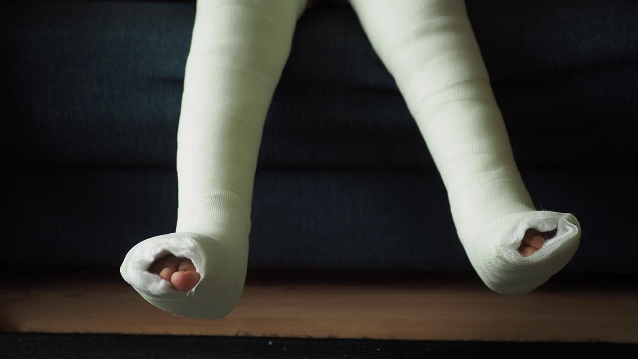 다리가 부러진 아이가 에 여 있습니다.