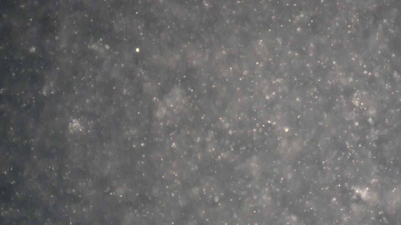 acercamiento a los espermatozoides humanos nadando en el líquido seminal