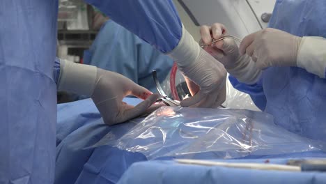 las cirugías mínimamente invasivas abarcan técnicas quirúrgicas que limitan el tamaño de las incisiones necesarias y, por lo tanto, disminuyen el tiempo de cicatrización de heridas, el dolor asociado y el riesgo de infección.
