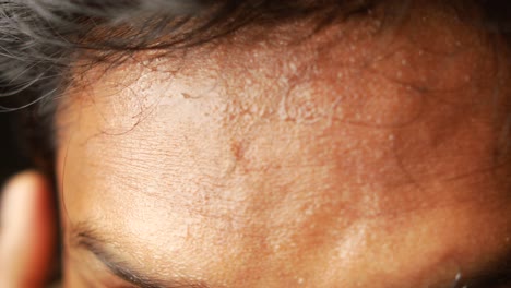 close up of a person's sweaty forehead