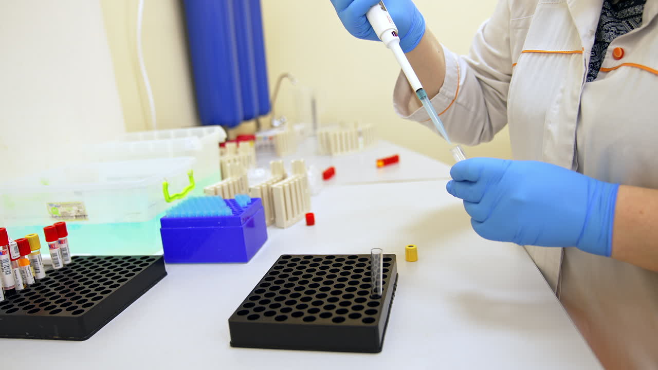 Female laboratory assistant filling the test glasses with liquid from special device. Modern science biomedical laboratory at hospital.