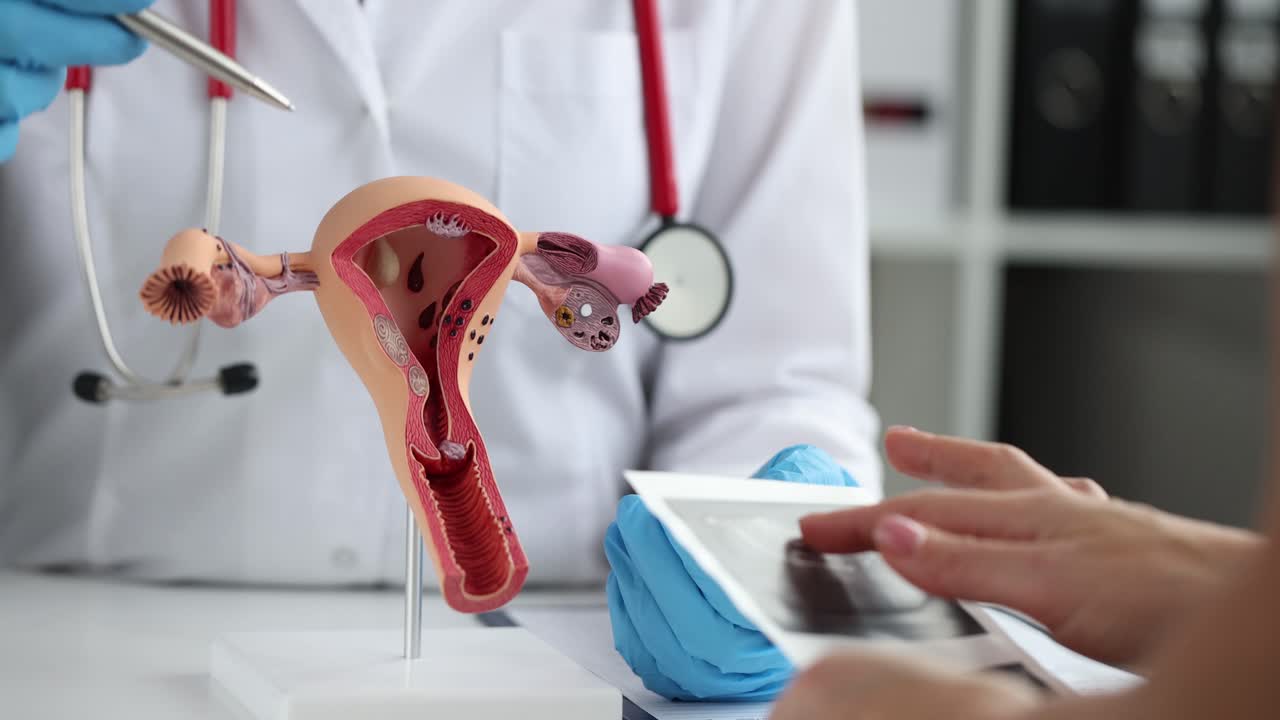 Ginecologa consulta una donna con l'ecografia dell'utero.