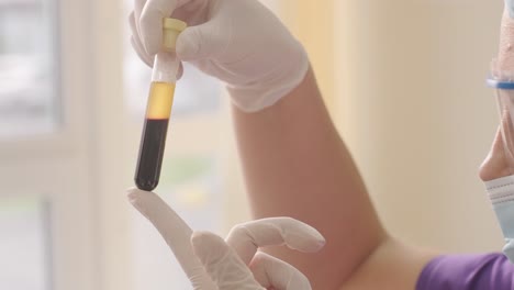 preparación de plasma rico en plaquetas. tubo con sangre en las manos.