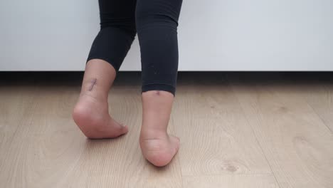 Child with ankle scars