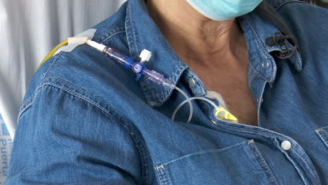 patient receiving iv infusion