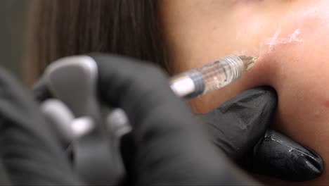 close-up of a face injection procedure