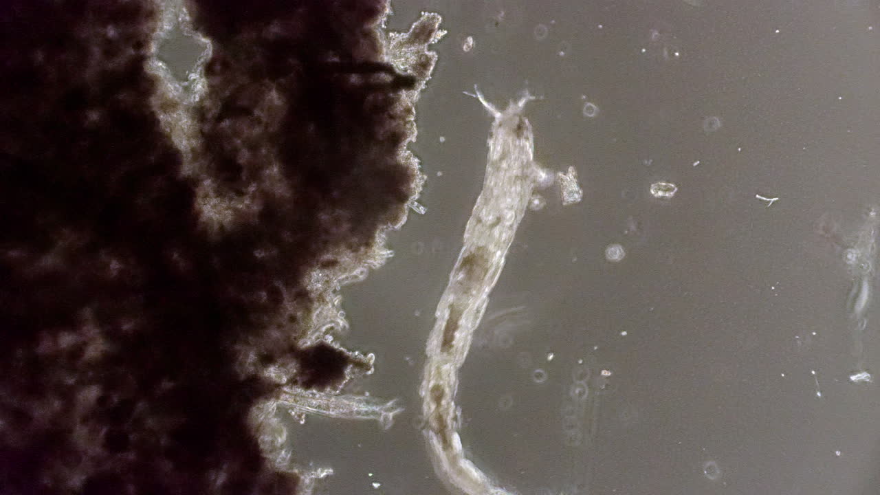 un animal microscópico se arrastra hacia arriba y fuera del marco