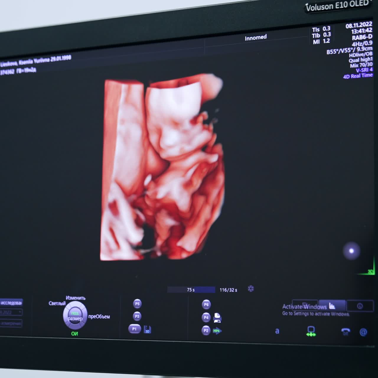 3d image of an unborn baby on the monitor of ultrasound machine. Pregnancy check up