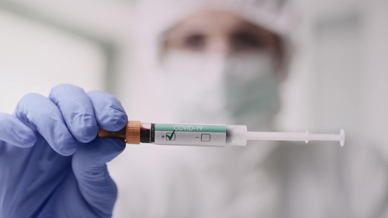 resultado médico positivo de coronavirus