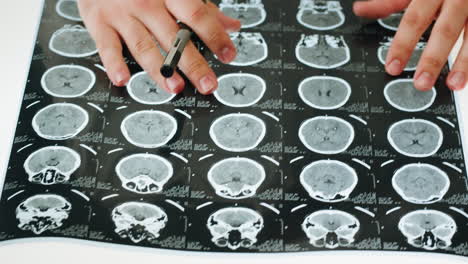 medical professional examining brain scans (mri/ct)