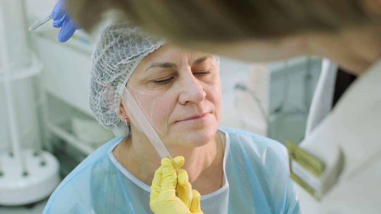 marcado antes de los procedimientos para el rejuvenecimiento de la piel de la cara. cosmetología de hardware profesional