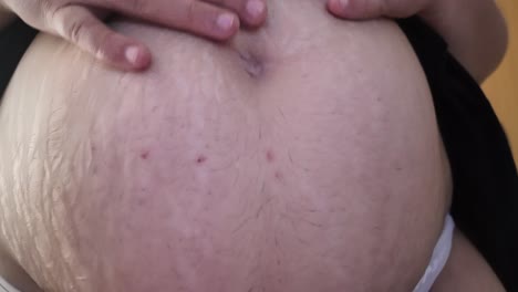 overweight person squeezing belly fat and wiggling it. close up