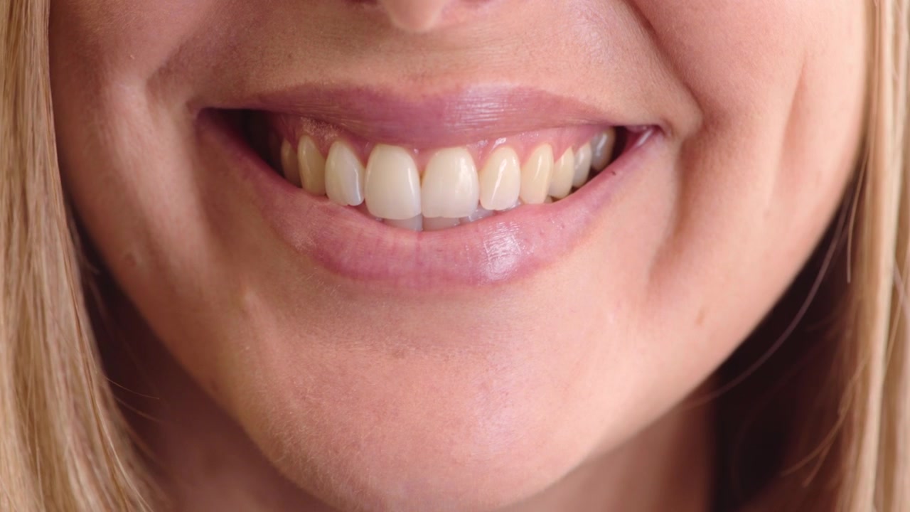 Close-up of a Woman Smiling Showing Her Teeth