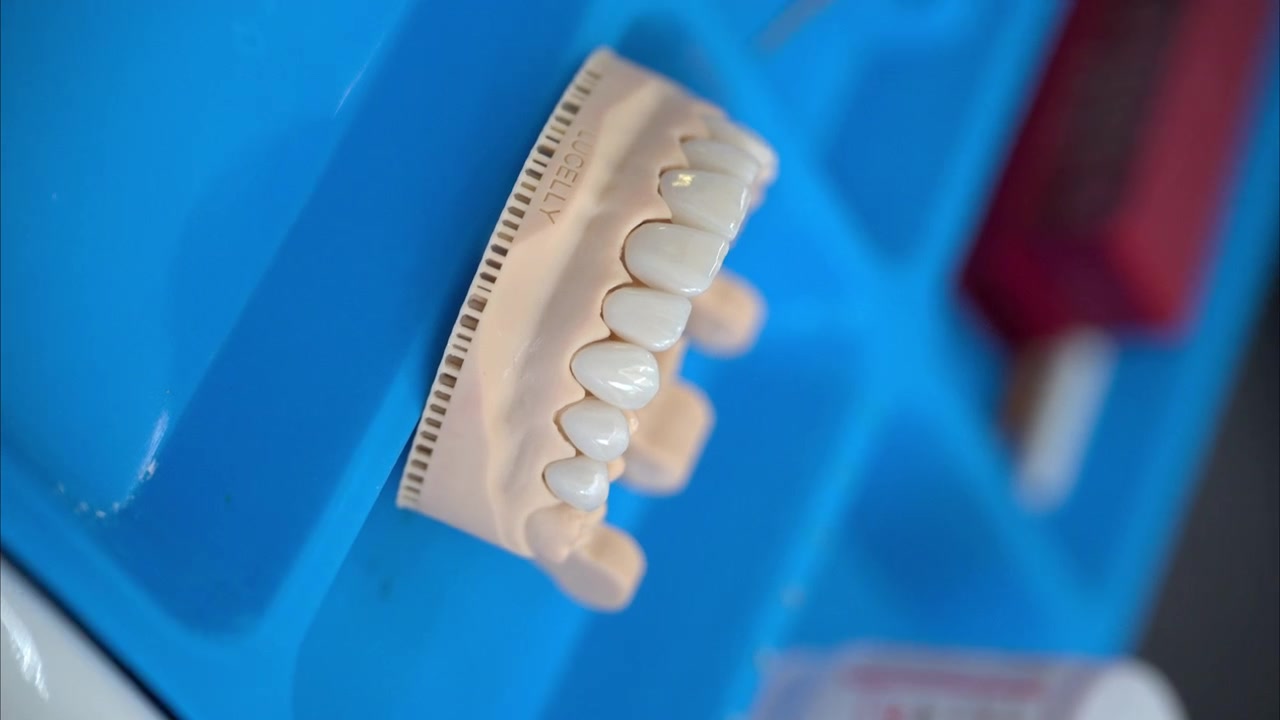 Panning vertical shot of a silicone mold with a new set of ceramic composite veneers.