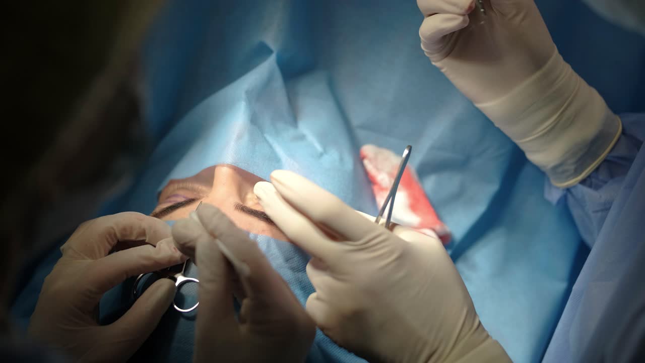 blefaroplastia cirugía plástica operación de rejuvenecimiento, modificación de la región del ojo