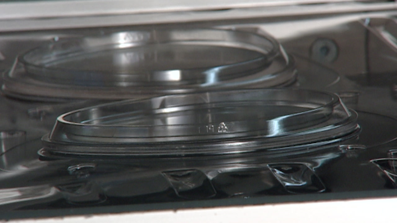 Plastic parts shaped with compression force