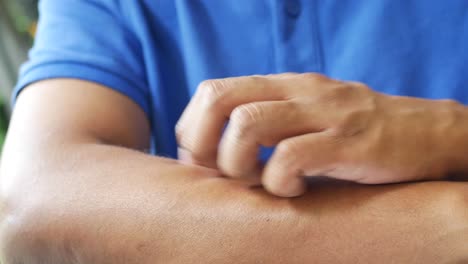 man suffering from itching skin, close up