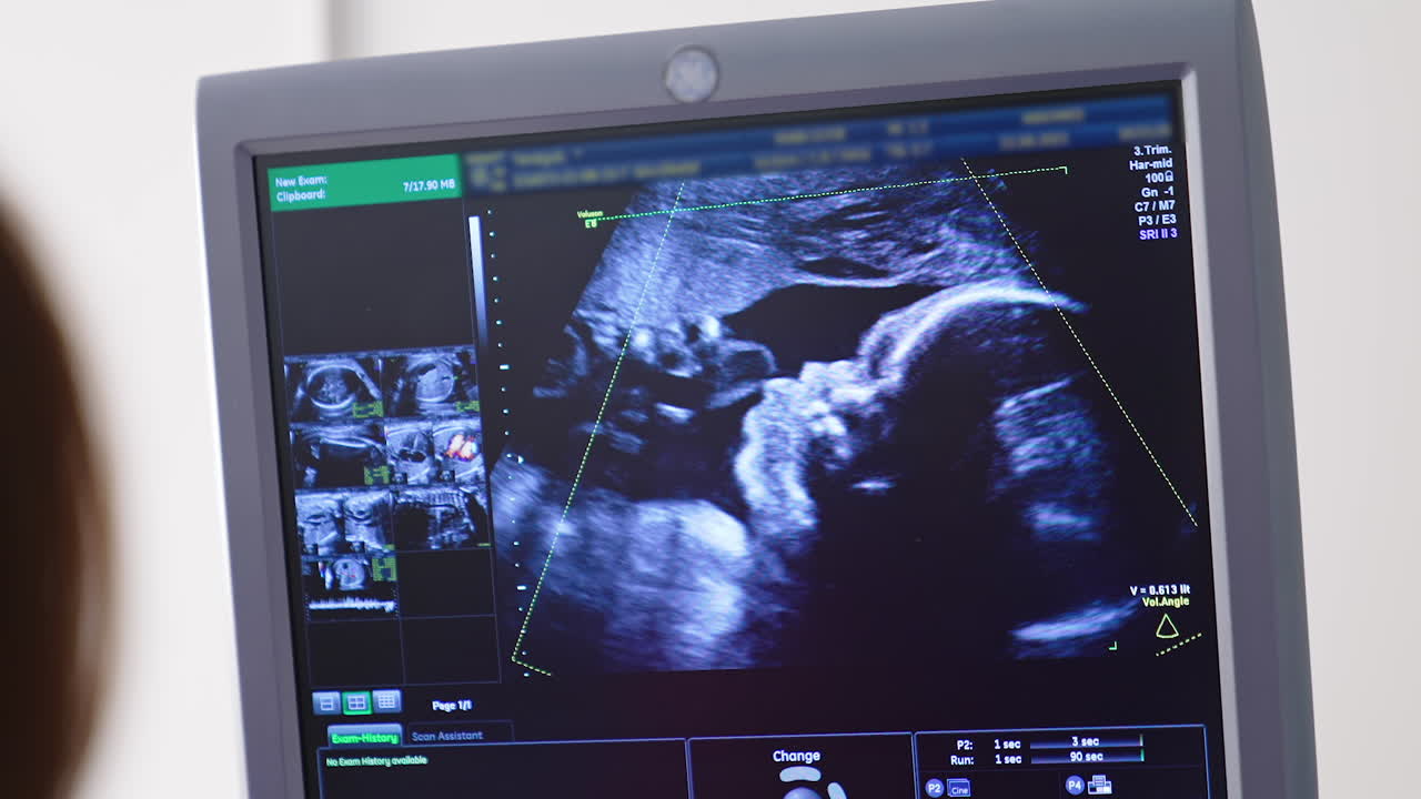 Ultrasound baby in a mother's womb. Modern ultrasound examination during pregnancy.