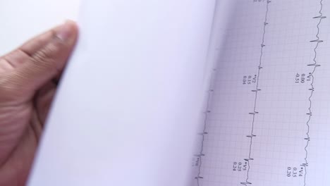 documento de ecg (electrocardiograma)