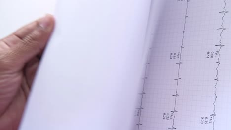 ecg (electrocardiogram) document