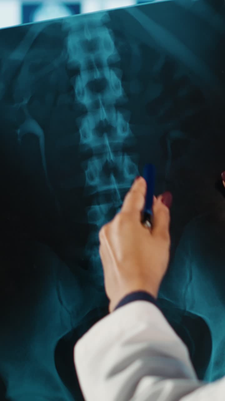 Female Doctor Examining Spine X-ray in Medical Office