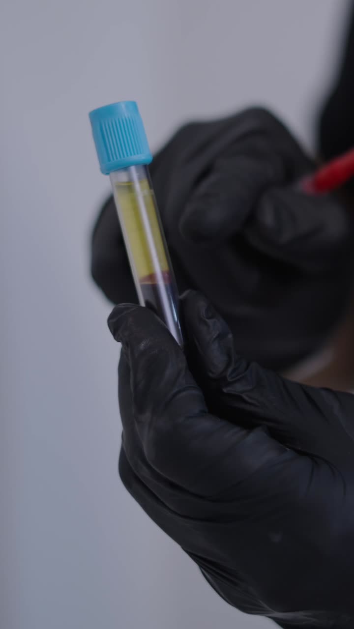 Blood Sample Analysis