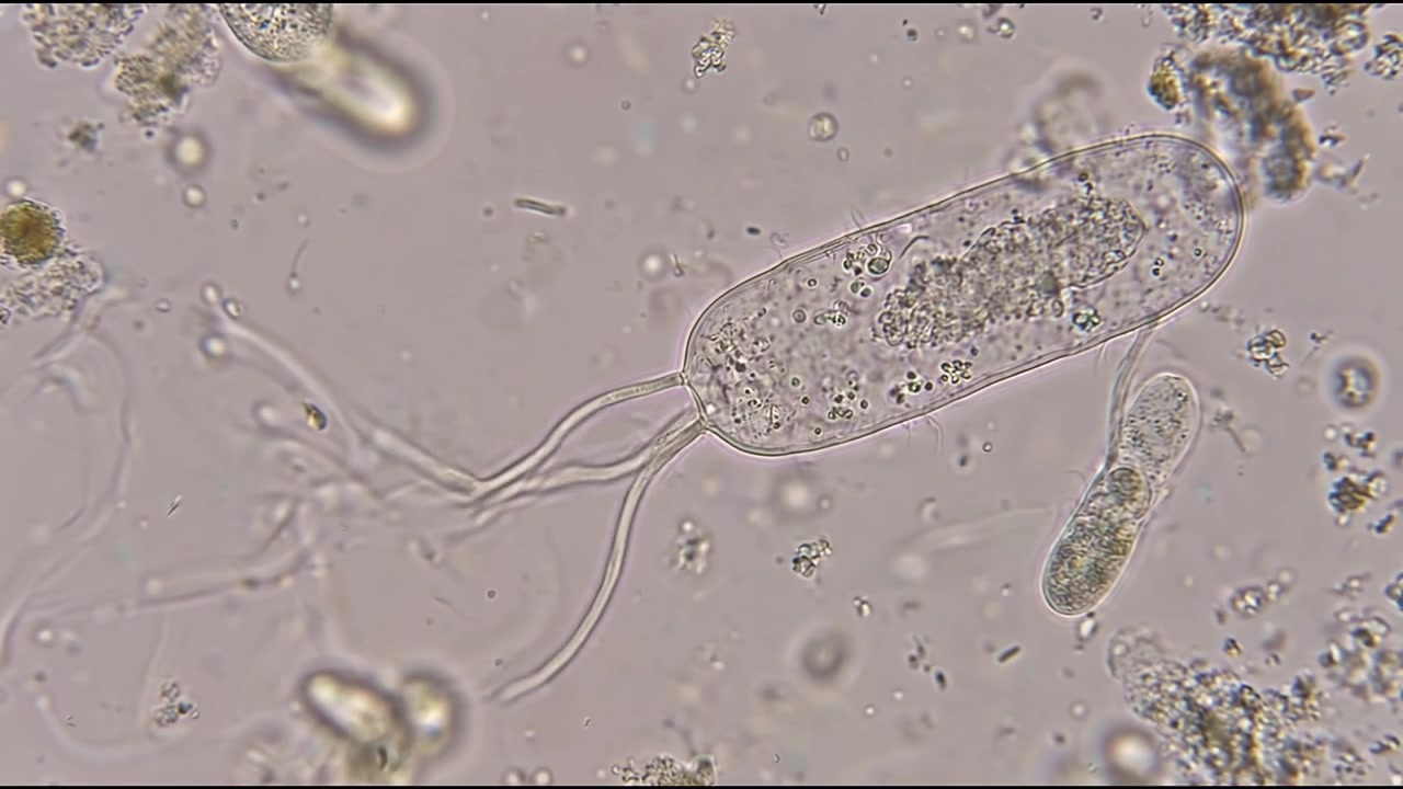 Vista microscopica di un protozoo ciliato che nuota nell'acqua