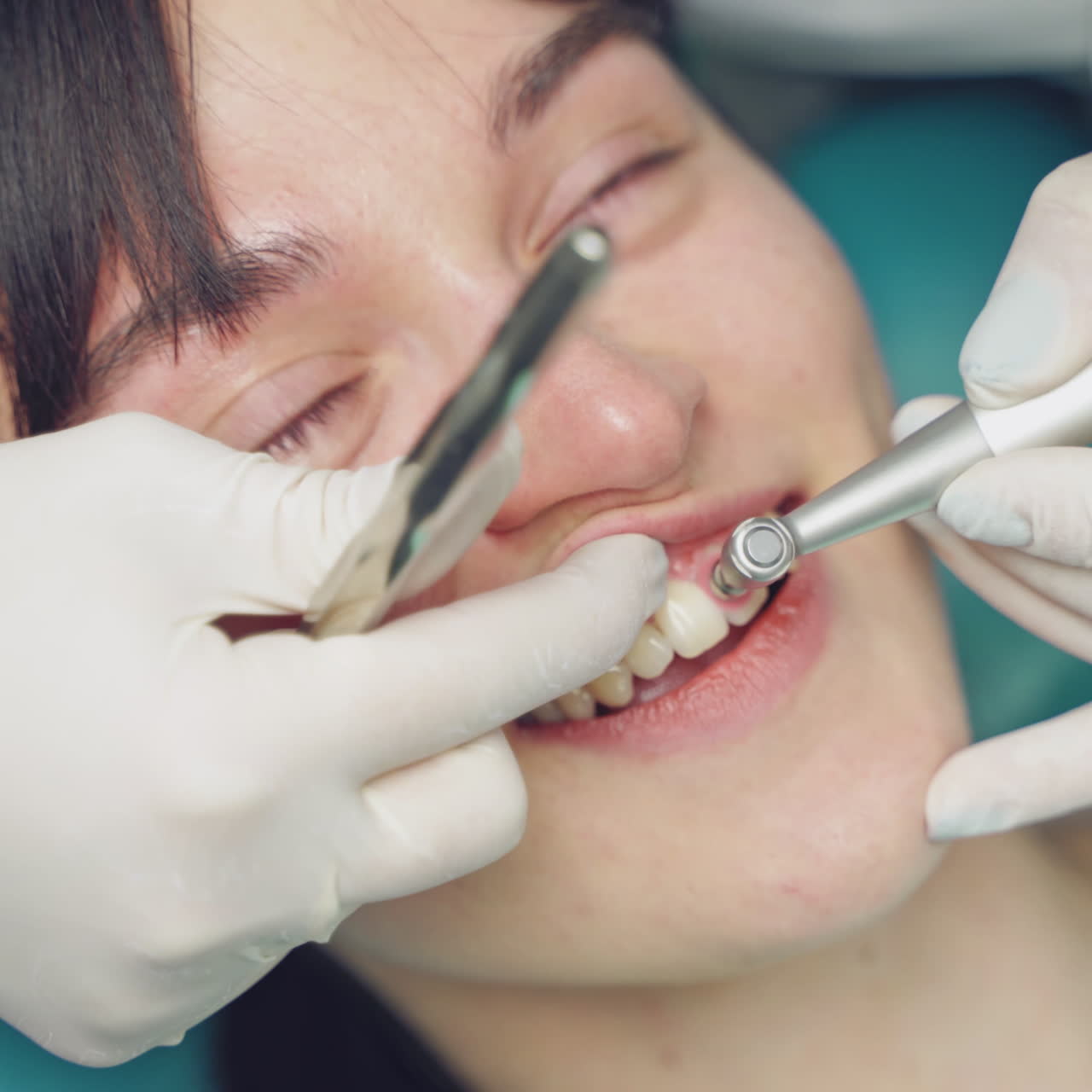 Dental hygienist polishing patient teeth in cosmetic dentistry clinic. Close up of a specialist working with patient in dentist office. Female patient moans a little during her visit at dentist.
