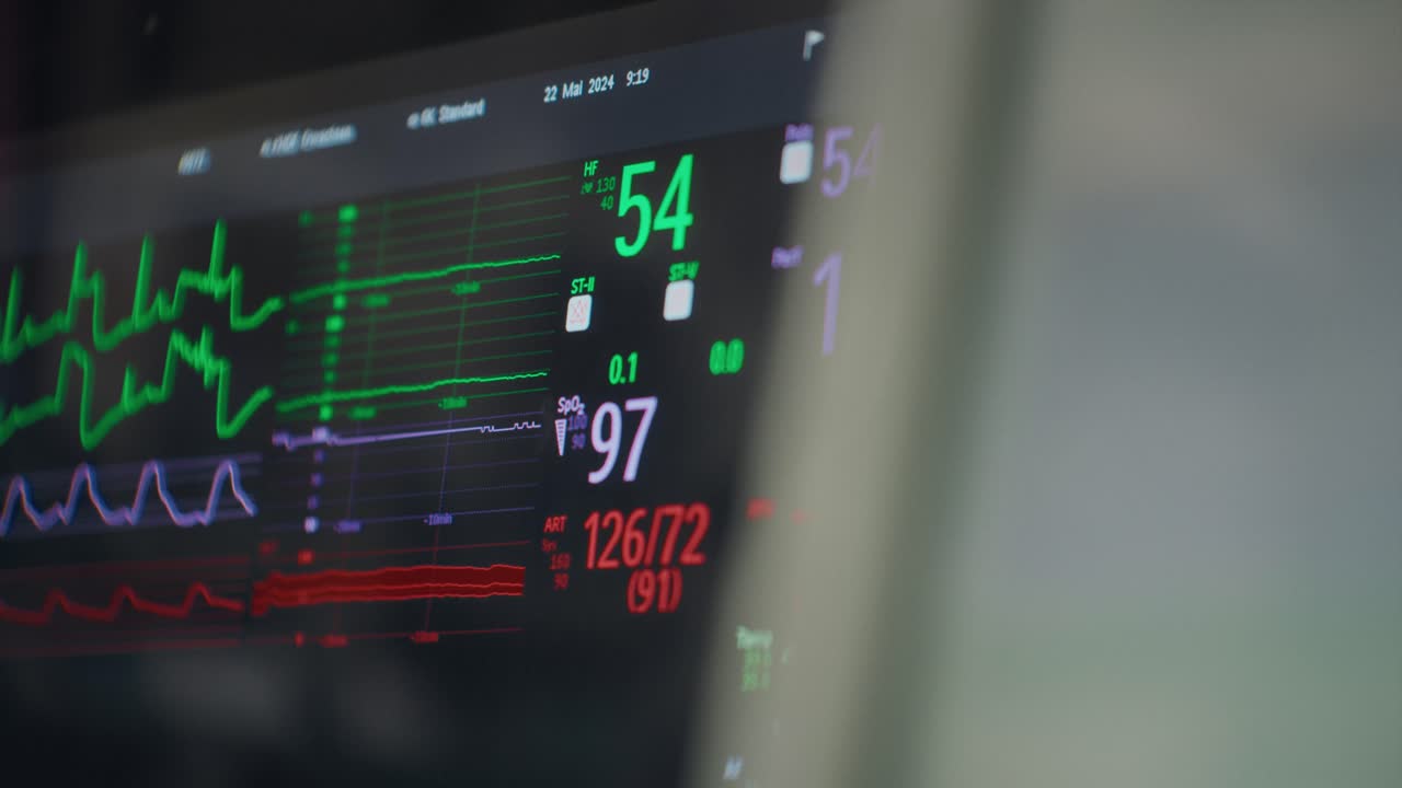 환자 모니터링 시스템의 클로즈업