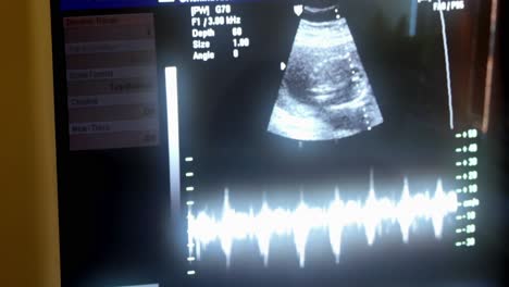 abdominal ultrasound scan