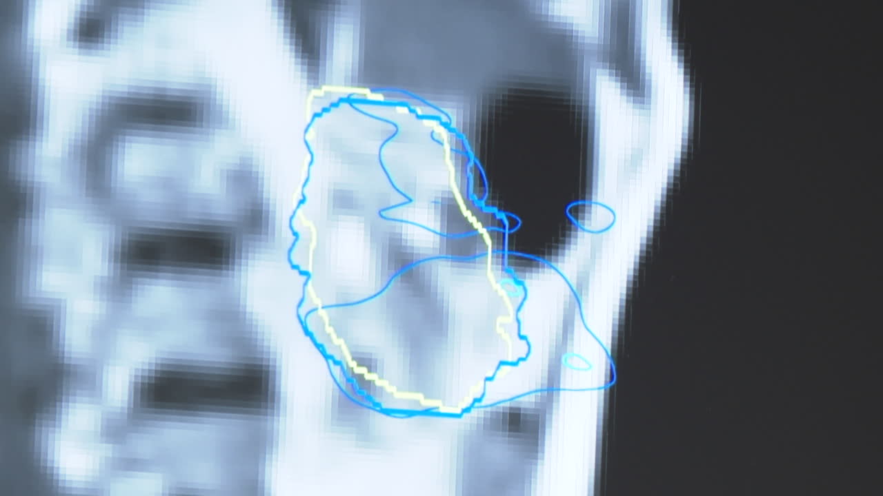 Medical Image with Contour Lines