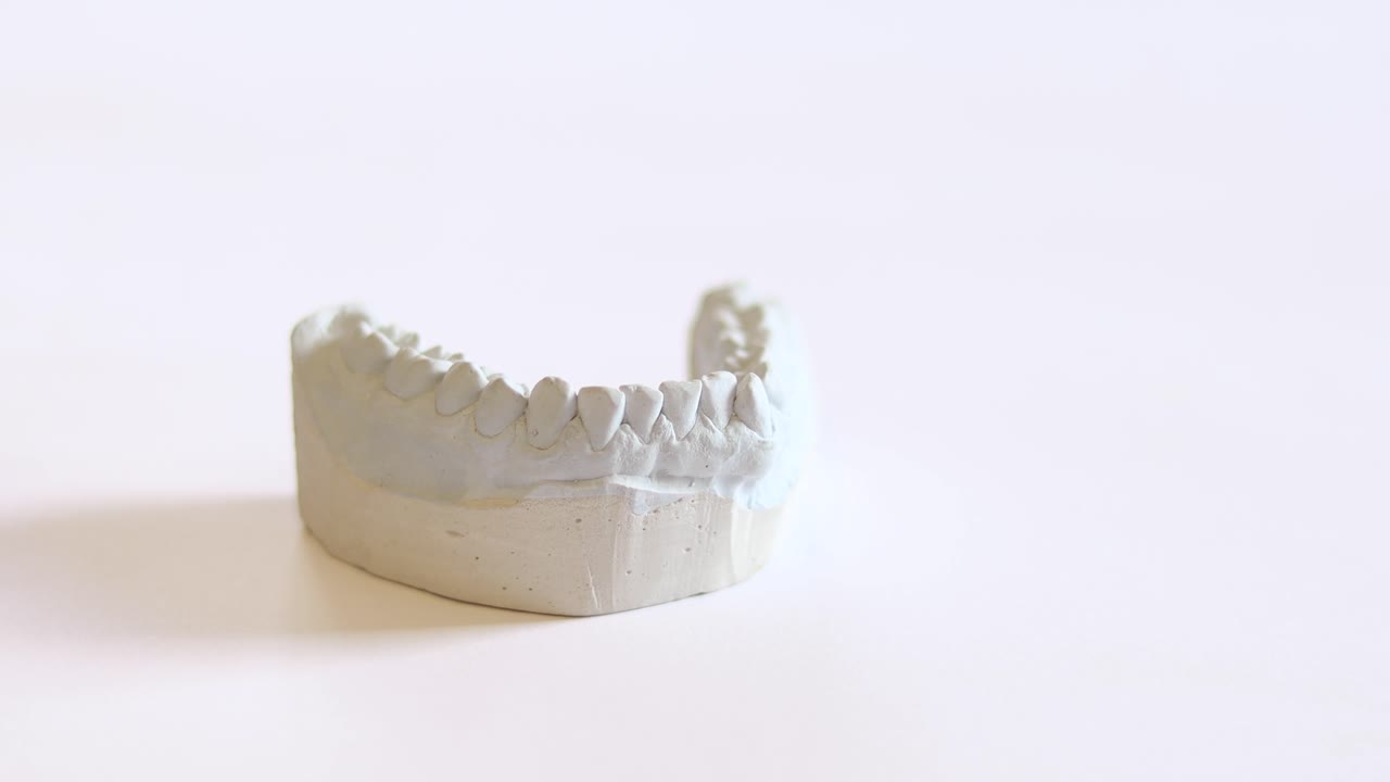 un dentista recoge y luego coloca una impresión dental, para hacer aparatos ortopédicos invisibles, bruxismo o dentaduras postizas, con la mano en un guante médico azul