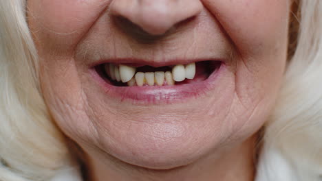 Nahaufnahme-Eines-Zahnlosen-Lächelns-Im-Mund-Einer-älteren-Frau.-Zahnprobleme,-Schlechter-Zahnverlust