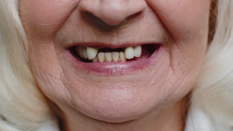 close-up macro of toothless smile mouth of female senior woman dental problem, bad teeth loss