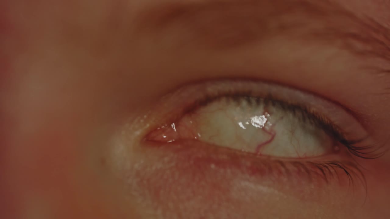 머리 안에서 뒤로 굴러가고 뒤로 돌아가는 눈의 거시적 시각