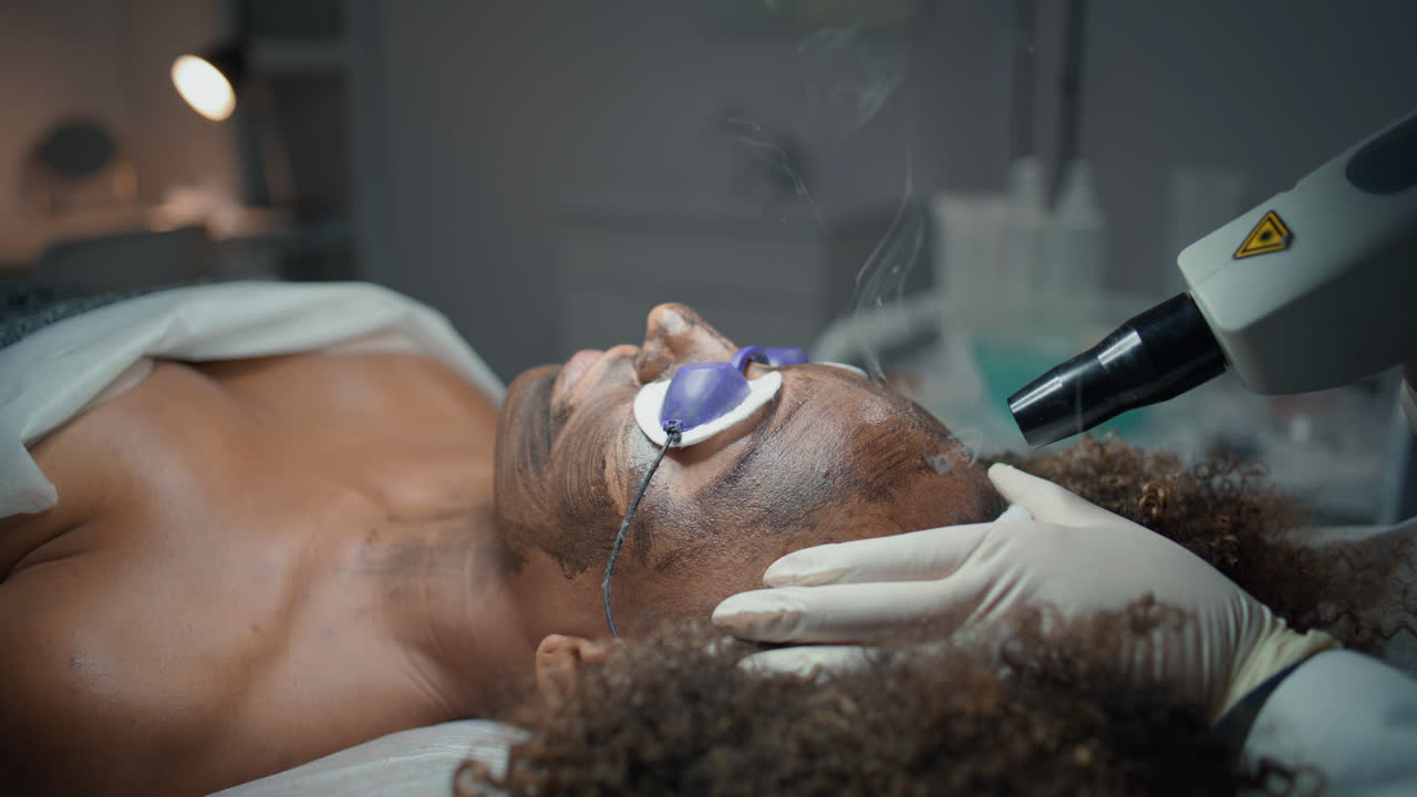 esteticista haciendo peeling de carbono en el salón de primer plano. tratamiento de cosmetología de elevación