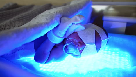 tiny newborn in diaper and socks on hands lies on the uv lamp. infant with pacifier and bandage on eyes is getting treatment from neonatal jaundice. close up.