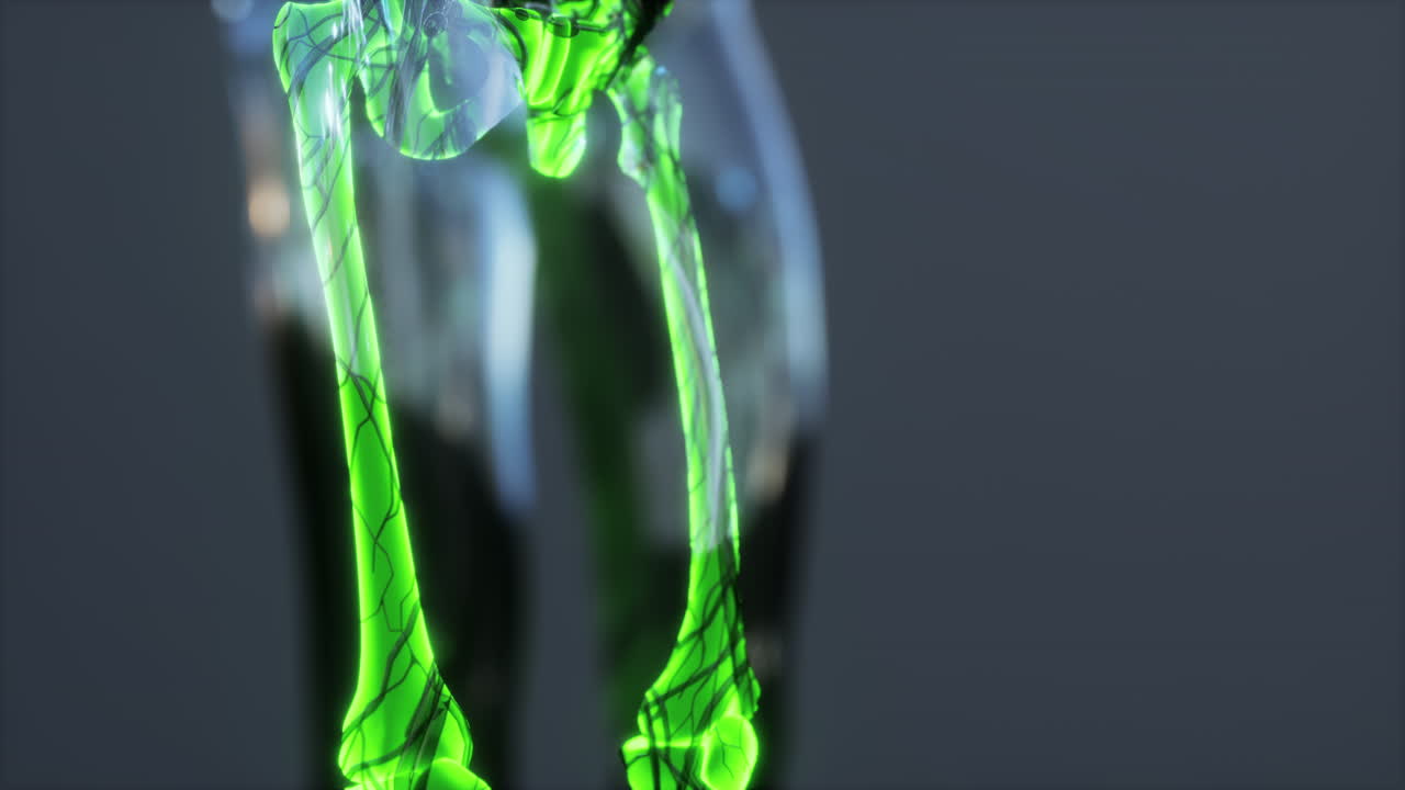 전체 골격의  ⁇ 스레이 밝기 빛