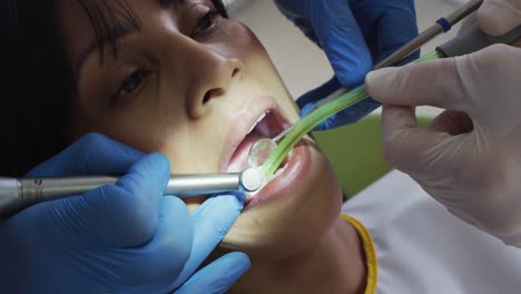 Manos-De-Un-Dentista-Masculino-Con-Una-Enfermera-Dental-Examinando-Los-Dientes-De-Una-Paciente-En-Una-Clínica-Dental-Moderna