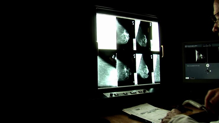 Un medico usa una lente d'ingrandimento per esaminare attentamente le radiografie.
