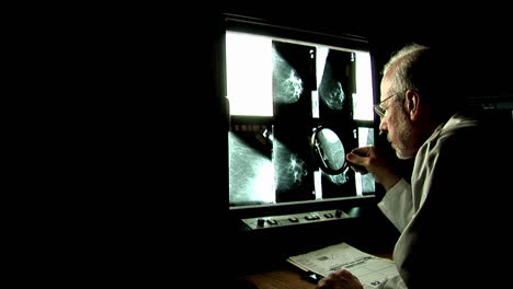 un médico usa una lupa para examinar de cerca las radiografías